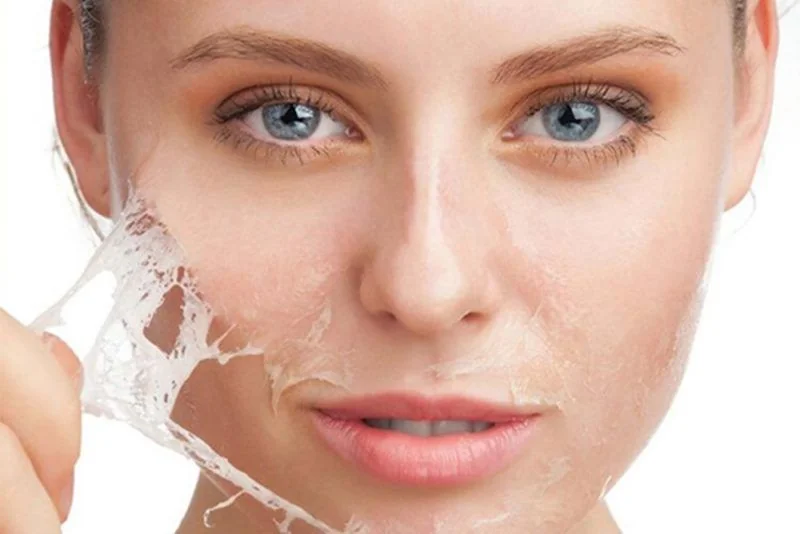 A demonstration of a facial skin peel