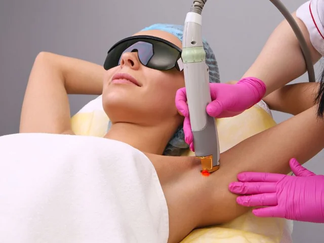 Laser hair treatment with protective eyewear