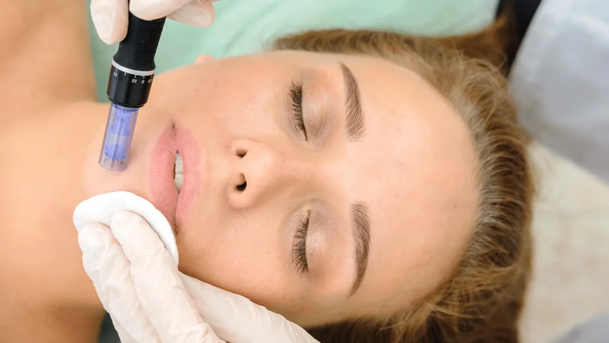 A demonstration of facial microneedling