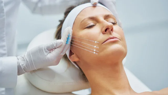 Facial assessment and marking for thread-lift training